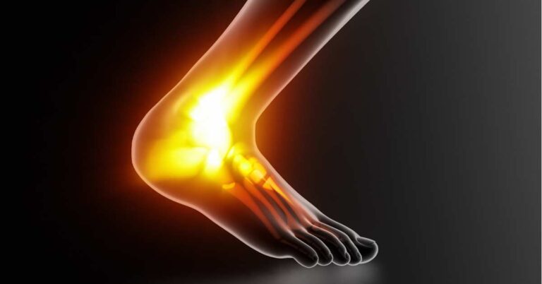 Achilles Tendinopathy